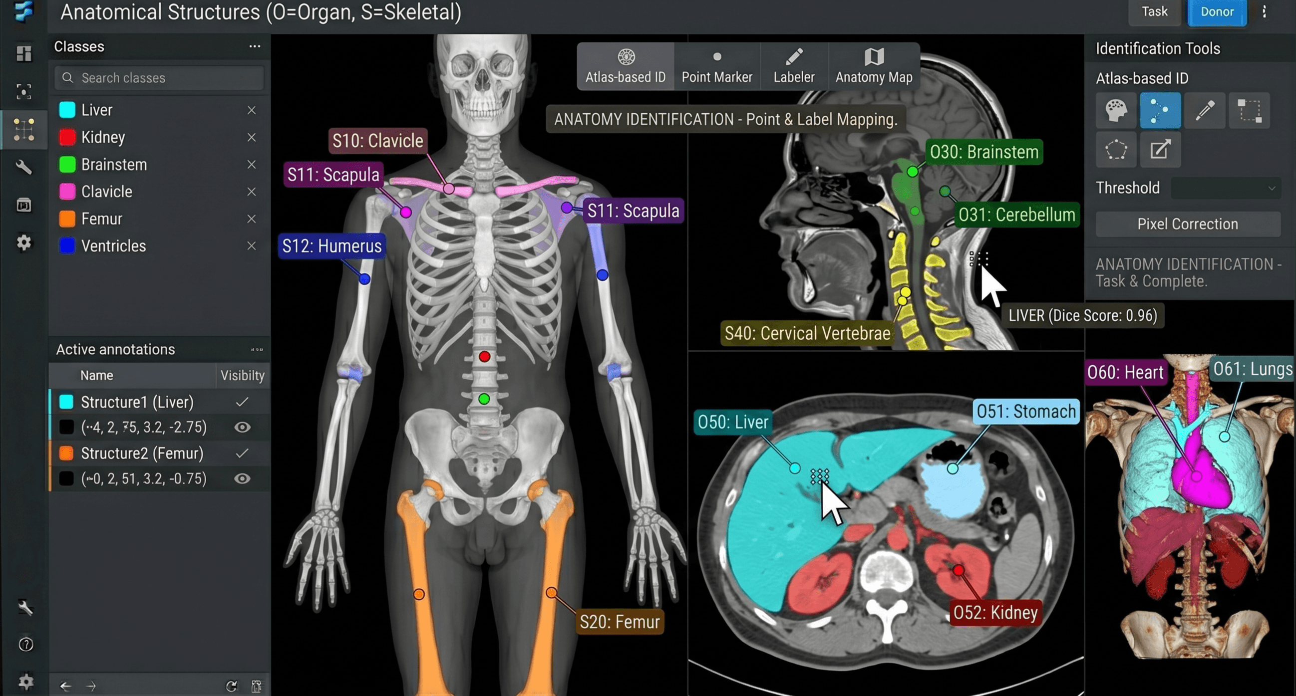 Anatomical structure labeling on MRI, CT, and 3D medical imaging