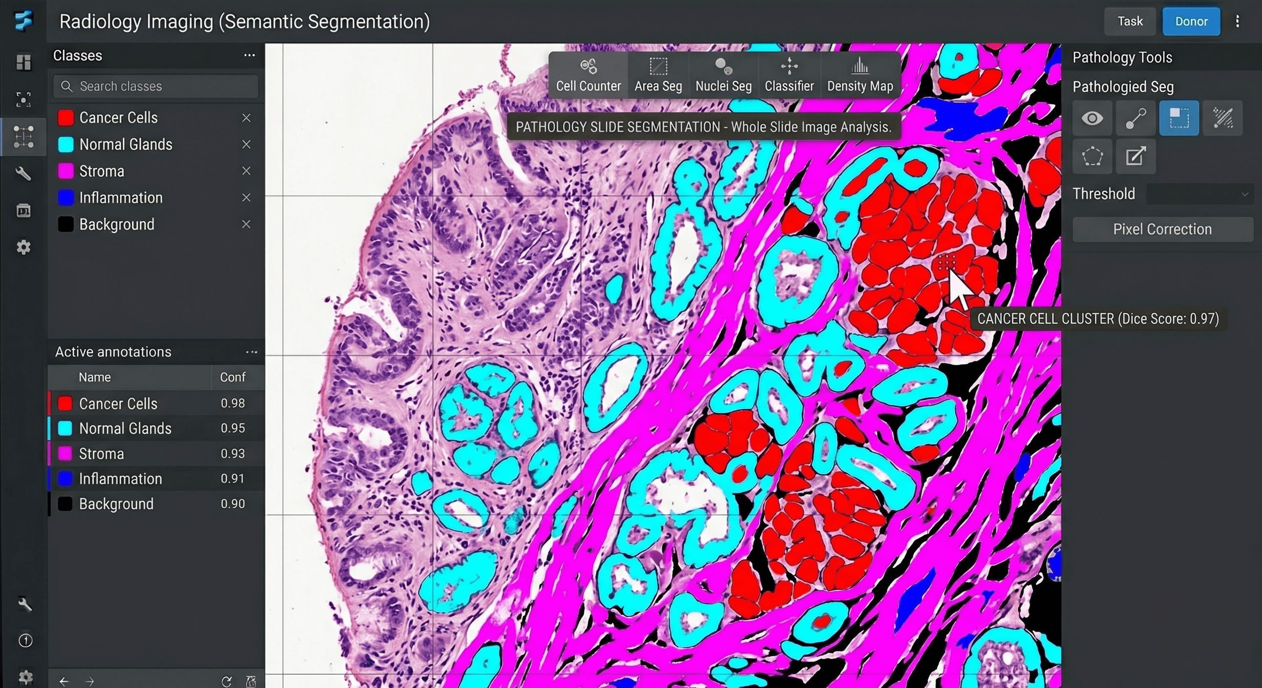 Digital pathology whole slide image annotation and segmentation